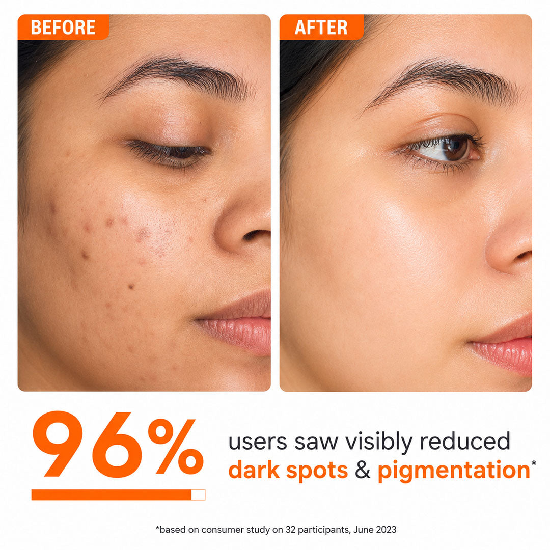 Mophy Vitamin C Brightening Face Serum