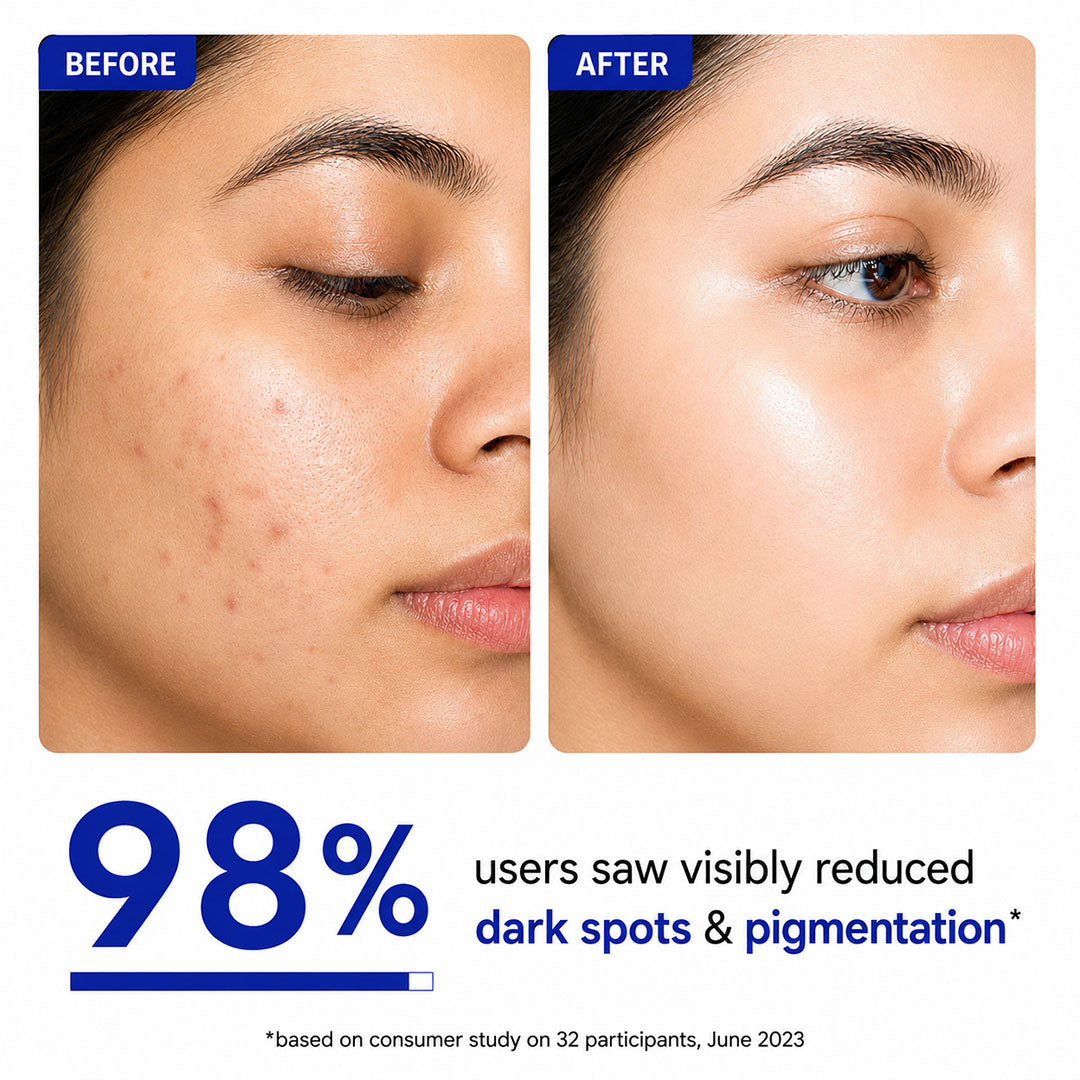 Niacinamide acid Face Serum