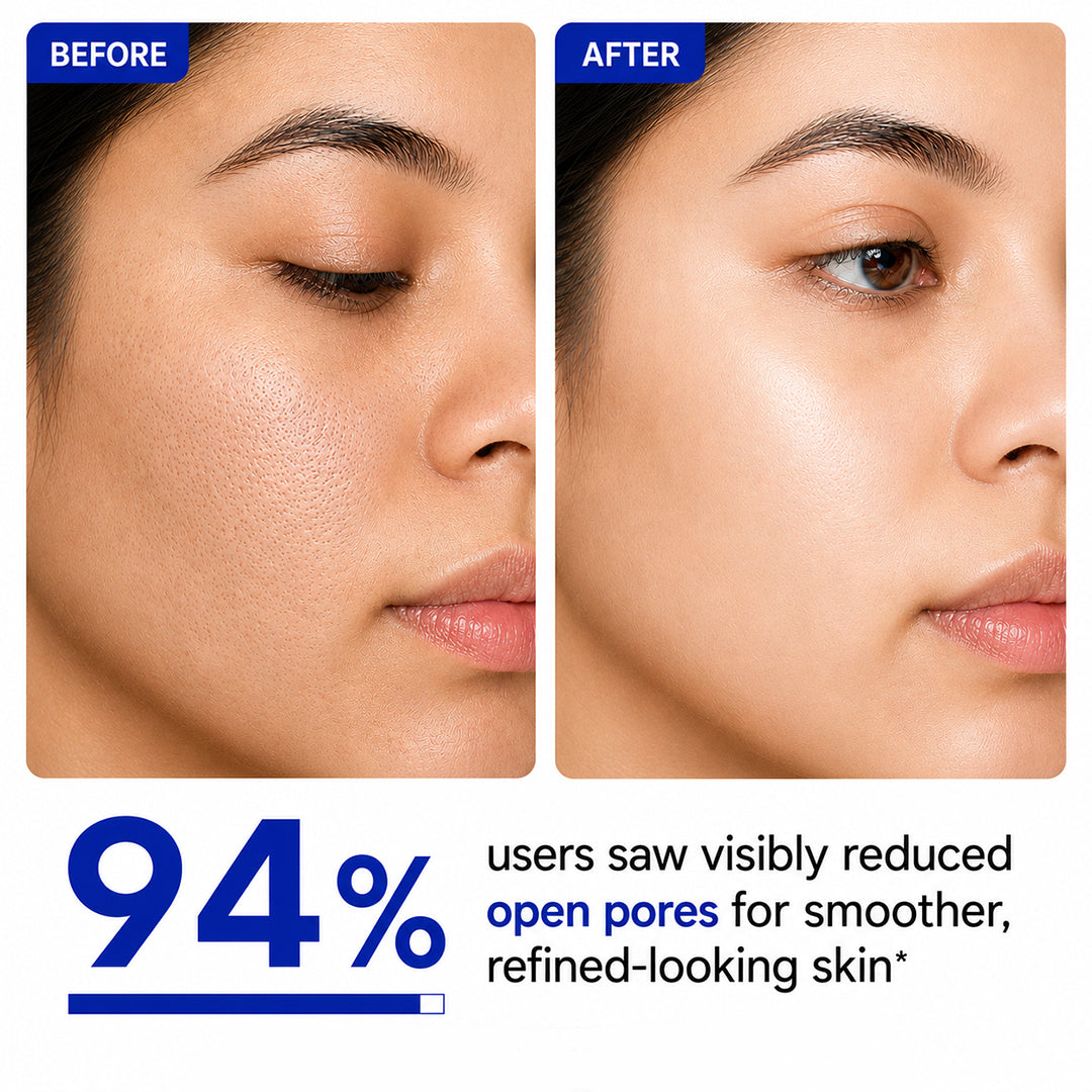Mophy Niacinamide 10% + Zinc 1% Serum