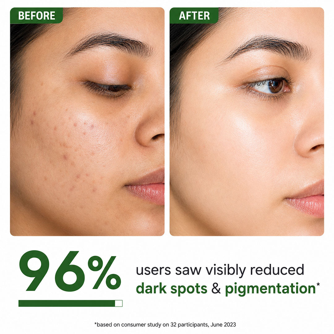 Salicylic acid Face Serum