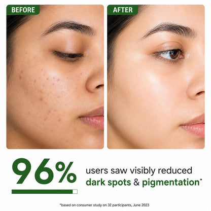 Salicylic acid Face Serum