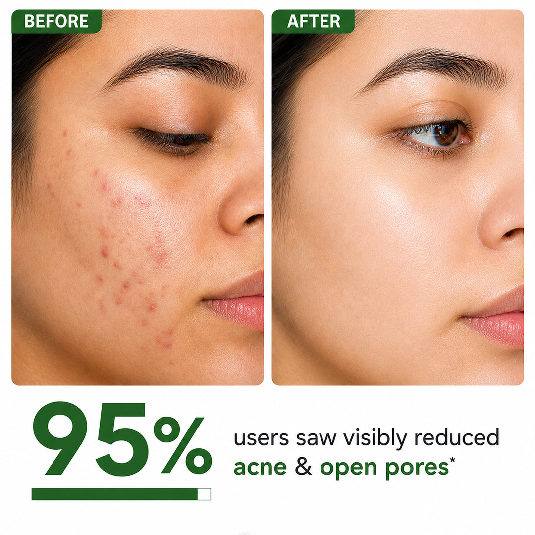 Mophy Salicylic Acid 2% Face Serum