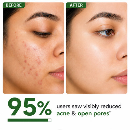 Mophy Salicylic Acid 2% Face Serum